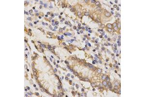 Immunohistochemistry of paraffin-embedded human stomach using TAPBP Antibody. (TAPBP 抗体)