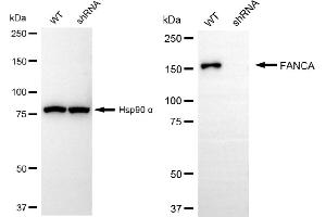 Western blotting analysis using FANCA antibody (ABIN7798563). (Recombinant FANCA 抗体)