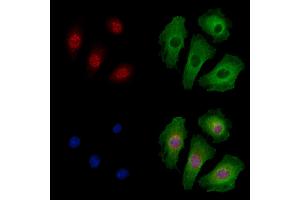 Phospho-RUNX2 (Ser319) Antibody staining A549 cells(4h of LPS treatment) by IF/ICC. (RUNX2 抗体  (pSer319))