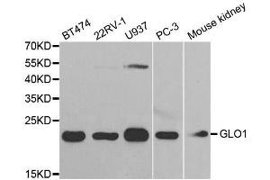 Western blot analysis of extracts of various cell lines, using GLO1 antibody. (GLO1 抗体  (AA 1-184))