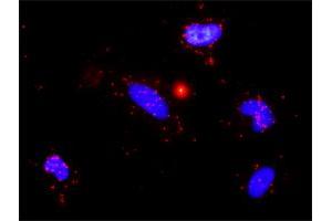 Proximity Ligation Assay (PLA) image for anti-Matrix Metallopeptidase 9 (Gelatinase B, 92kDa Gelatinase, 92kDa Type IV Collagenase) (MMP9) (AA 1-707) antibody (ABIN517965)