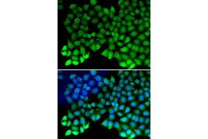 Immunofluorescence analysis of MCF7 cell using RPA1 antibody. (RPA1 抗体  (AA 367-616))