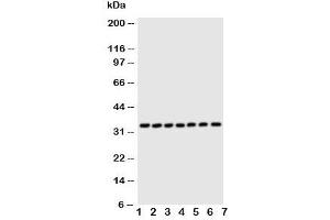 Western blot testing of DCI antibody and Lane 1:  rat liver;  2: human placenta;  3: A549;  4: SMMC-7721;  5: COLO320;  6: HeLa;  7: HT1080 cell lysate (DCI 抗体  (C-Term))