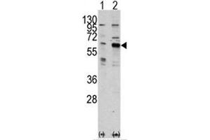 Western blot analysis of PAK3 antibody and 293 cell lysate either nontransfected (Lane 1) or transiently transfected with the PAK3 gene (2). (PAK3 抗体  (AA 218-247))