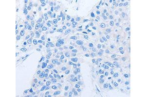 Immunohistochemistry (IHC) image for anti-Neurotrophin 3 (NTF3) antibody (ABIN1873967) (Neurotrophin 3 抗体)