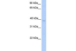 WB Suggested Anti-LASS4 Antibody Titration:  0. (LASS4 抗体  (C-Term))