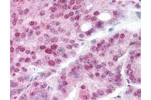 Image no. 2 for anti-Heat Shock Protein 90kDa alpha (Cytosolic), Class A Member 1 (HSP90AA1) (acLys294) antibody (ABIN401378)