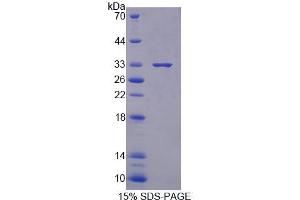 SDS-PAGE analysis of Mouse XYLT1 Protein. (XYLT1 蛋白)