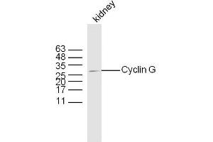 Mouse kidney lysates probed with Rabbit Anti-Cyclin G Polyclonal Antibody, Unconjugated  at 1:300 overnight at 4˚C. (Cyclin G1 抗体  (AA 181-295))