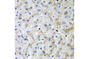 Immunohistochemistry of paraffin-embedded human liver damage using SRGN antibody (ABIN6132571, ABIN6148441, ABIN6148443 and ABIN6222700) at dilution of 1:200 (40x lens). (SRGN 抗体  (AA 28-158))