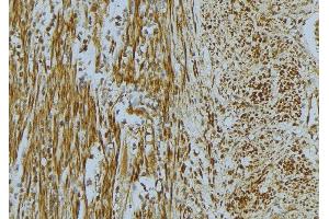 ABIN6268668 at 1/100 staining Mouse muscle tissue by IHC-P. (Vinculin 抗体  (N-Term))