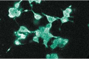 Immunofluorescence staining of PC12 cells (Rat neuroblastoma, ATCC CRL-1721). (DLG4 抗体  (AA 353-504))