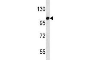 TLR7 antibody western blot analysis in HepG2 lysate (TLR7 抗体  (AA 899-926))
