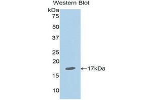 Western Blotting (WB) image for anti-Nuclear Receptor Subfamily 3, Group C, Member 1 (Glucocorticoid Receptor) (NR3C1) (AA 41-184) antibody (ABIN1174819) (Glucocorticoid Receptor 抗体  (AA 41-184))