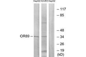 Western blot analysis of extracts from HepG2/HuvEc cells, using OR89 Antibody. (OR89 抗体  (AA 220-269))