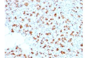 Formalin-fixed, paraffin-embedded human Pancreas stained with BARX1 Mouse Monoclonal Antibody (BARX1/2759). (BARX1 抗体  (AA 155-254))