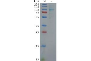 SDS-PAGE (SDS) image for Fibroblast Activation Protein, alpha (FAP) (AA 30-760) protein (His tag) (ABIN7092782)