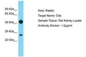 Image no. 1 for anti-Clathrin, Light Chain A/B (CLTA/CLTB) (C-Term) antibody (ABIN6750433) (CLTA/CLTB 抗体  (C-Term))