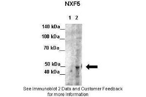 Western Blotting (WB) image for anti-Nuclear RNA Export Factor 5 (NXF5) (Middle Region) antibody (ABIN2776599)