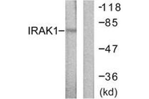Western blot analysis of extracts from HeLa cells, using IRAK1 (Ab-387) Antibody. (IRAK1 抗体  (AA 353-402))