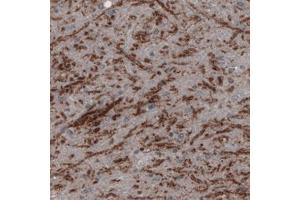 Immunohistochemical staining (Formalin-fixed paraffin-embedded sections) of human substantia nigra pars reticulata with SLC32A1 monoclonal antibody, clone CL2793  shows positivity in GABAergic neural fibers. (SLC32A1 抗体)