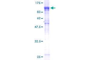 Image no. 1 for Nucleoporin 85kDa (NUP85) (AA 1-656) protein (GST tag) (ABIN1313244) (NUP85 Protein (AA 1-656) (GST tag))