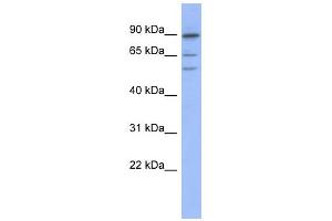 WB Suggested Anti-TRIM50 Antibody Titration:  0. (TRIM50 抗体  (Middle Region))