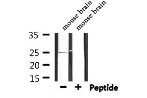 Western blot analysis of extracts from mouse brain, using PRDX6 Antibody. (Peroxiredoxin 6 抗体  (Internal Region))