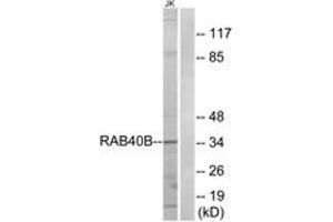 Western blot analysis of extracts from Jurkat cells, using RAB40B Antibody. (RAB40B 抗体  (AA 229-278))