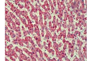 Human Liver: Formalin-Fixed, Paraffin-Embedded (FFPE) (ANTXR2 抗体)