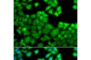 Immunofluorescence analysis of A549 cells using NLRC4 Polyclonal Antibody (NLRC4 抗体)