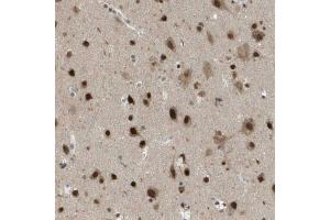 Immunohistochemical staining (Formalin-fixed paraffin-embedded sections) of human cerebral cortex using KAT5 polyclonal antibody  shows strong nuclear positivity in neurons. (KAT5 抗体  (AA 150-286))