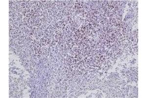 Immunohistochemistry (IHC) image for anti-CD8 (CD8) antibody (ABIN1449140) (CD8 抗体)