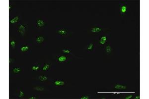 Immunofluorescence of purified MaxPab antibody to WDR18 on HeLa cell. (WDR18 抗体  (AA 1-432))
