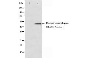 Western blot analysis of Synaptotagmin phosphorylation expression in Forskolin treated 293 whole cell lysates,The lane on the left is treated with the antigen-specific peptide. (Synaptotagmin 抗体  (pThr202))