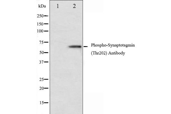 Synaptotagmin 抗体  (pThr202)