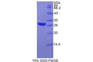 SDS-PAGE analysis of Rat Glypican 4 Protein. (GPC4 蛋白)