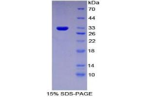 SDS-PAGE analysis of Rat IFNa/bR1 Protein.