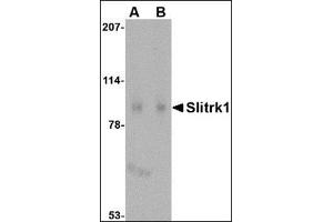 Western blot analysis of Slitrk1 in human brain tissue lysate with this product at (A) 1 and (B) 2 μg/ml. (SLITRK1 抗体  (C-Term))