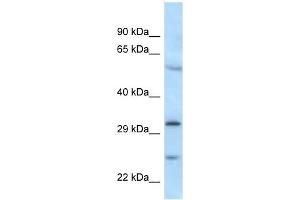 Western Blot showing MAD2L1BP antibody used at a concentration of 1 ug/ml against MDA-MB-435S Cell Lysate (MAD2L1BP 抗体  (N-Term))