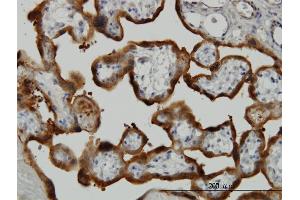 Immunoperoxidase of monoclonal antibody to TGM2 on formalin-fixed paraffin-embedded human placenta. (Transglutaminase 2 抗体  (AA 1-120))