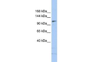 WB Suggested Anti-SMARCA5 Antibody Titration:  0. (SMARCA5 抗体  (N-Term))