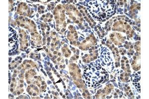 PHKG2 antibody was used for immunohistochemistry at a concentration of 4-8 ug/ml to stain Epithelial cells of renal tubule (Indicated with Arrows) in Human kidney. (PHKG2 抗体)