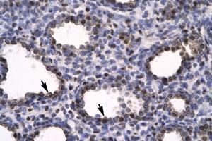 Image no. 1 for anti-High Mobility Group Box 2 (HMGB2) (C-Term) antibody (ABIN6735776) (HMGB2 抗体  (C-Term))