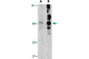 Western blot analysis of HAVCR1 in human uterus tissue lysate with HAVCR1 polyclonal antibody  at (A) 1 and (B) 2 ug/mL . (HAVCR1 抗体  (N-Term))