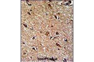 Immunohistochemistry (Paraffin-embedded Sections) (IHC (p)) image for anti-Isocitrate Dehydrogenase 1 (NADP+), Soluble (IDH1) (AA 63-90), (N-Term) antibody (ABIN391659)