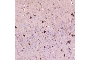 IHC analysis of Cystatin C using anti-Cystatin C antibody (ABIN5692829). (CST3 抗体  (AA 31-146))