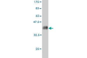 Western Blotting (WB) image for anti-Acyl-CoA Synthetase Long-Chain Family Member 5 (ACSL5) (AA 91-186) antibody (ABIN565656)