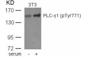 Image no. 1 for anti-phospholipase C, gamma 1 (PLCG1) (pTyr771) antibody (ABIN401590) (Phospholipase C gamma 1 抗体  (pTyr771))