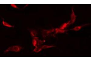 ABIN6278463 staining  Hela cells by IF/ICC. (FLT3 抗体  (C-Term))